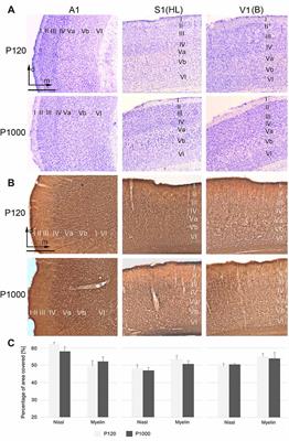 Crossmodal Connections of Primary Sensory Cortices Largely Vanish During Normal Aging